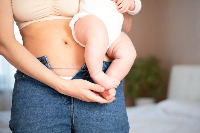 خسارة الوزن بعد الولادة