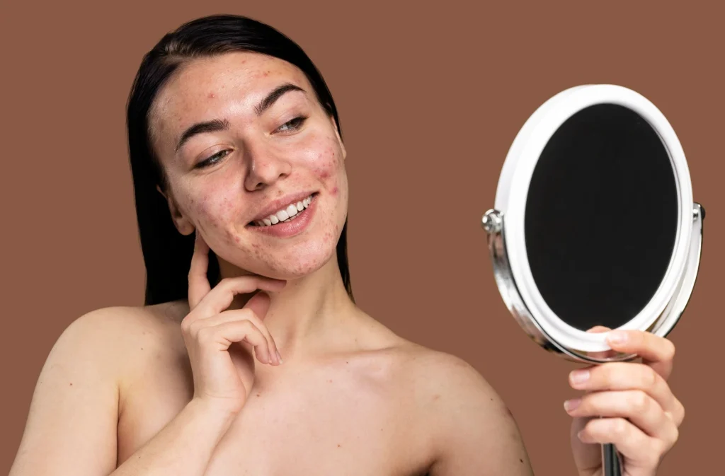 مشاكل البشرة