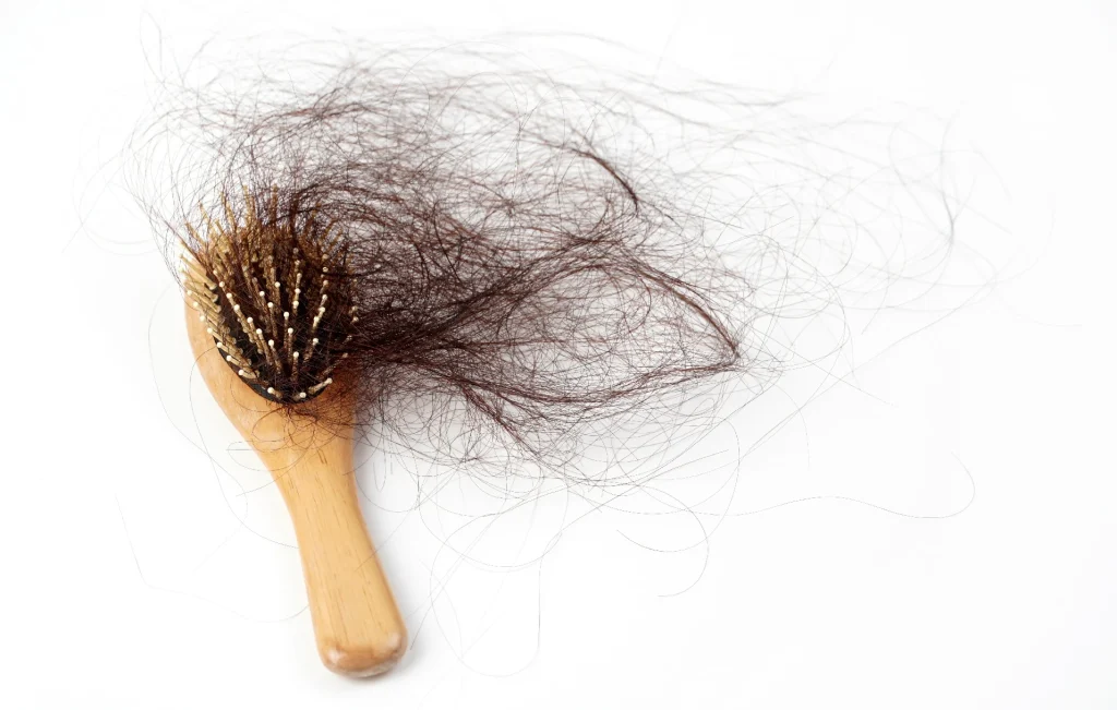 تساقط الشعر