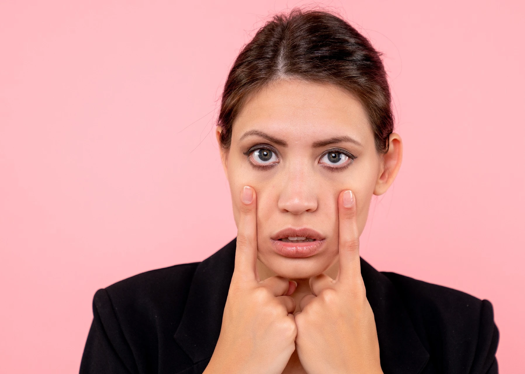 ما هي أسباب ظهور الهالات السوداء تحت العين؟ وكيف يمكن علاجها نهائيًا؟
